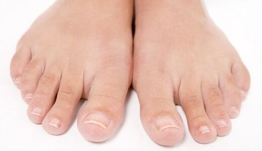 pés sans despois do tratamento de fungos