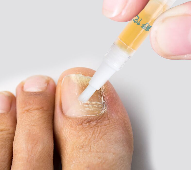líquido contra o fungo das unhas dos pés